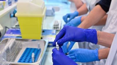 Pruebas PCR y rápidas harán laboratorios en el país. Foto referencial.