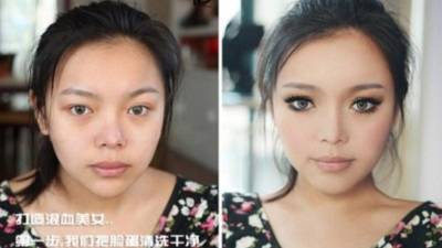 A los 35 años ya consideran que es necesario comenzarse a practicar cirugías sobre todo en el rostro.