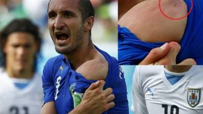 A mordidas, Uruguay se impone a Italia.