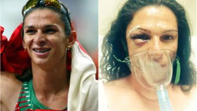 Guevara fue intervenida quirúrgicamente por una fractura en el maxilar.