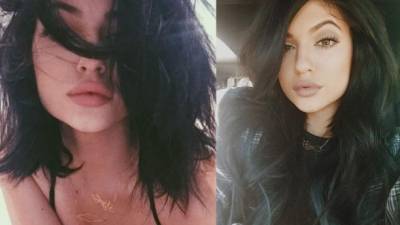 Los labios XXL de kylie Jenner han causado mucha controversia en los últimos meses.