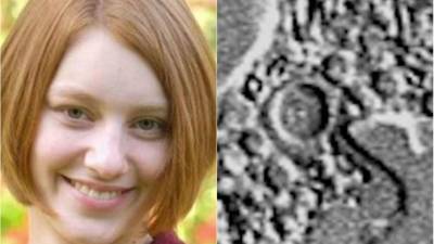 Lauren Seitz, de 18 años, murió a causa de una infección por la ameba 'comecerebros'.