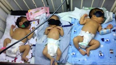 Tres bebés comparten la misma cuna en el hospital Mario Rivas. Foto: Facebook Dr. Elmer Mayes.