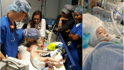 Momentos previos a la cirugía y Jadon ya separado de su hermano.