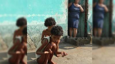 Las dos hermanas todos los días aguantan hambre y soportan los fuertes rayos del sol.