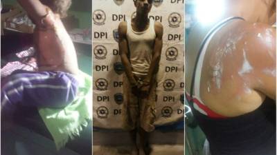 El hombre ya fue puesto a las órdenes de las autoridades.