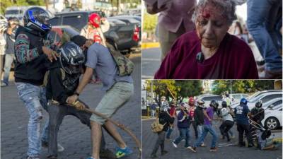 Decenas de personas resultaron heridas durante una protesta interrumpida por un grupo de personas que, con los rostros cubiertos por cascos de motociclistas, agredieron a manifestantes que se oponen a las reformas al Reglamento de la Ley de Seguridad Social, que aumenta la cuota patronal y laboral y crea una nueva cotización para los jubilados en Nicaragua.