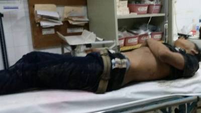 Los heridos se encuentran con vida en la sala de emergencias del Hospital Integrado de Santa Bárbara.