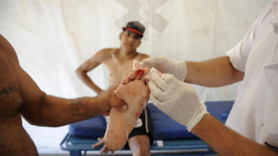 - Una fotografía cedida por el diario La Capital del 25 de diciembre de 2013 muestra a un bañista herido en el pie en Rosario (Argentina).