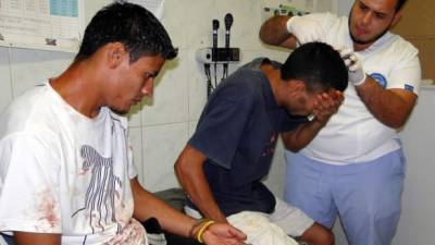 Los heridos fueron atendidos en el hospital público de El Progreso, luego fueron retornados al centro penal local.