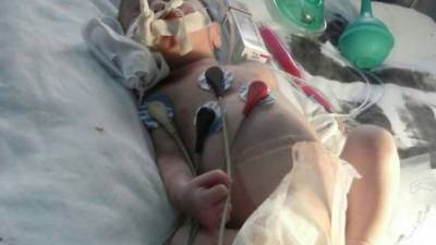 La Fiscalía investiga si la niña falleció a causa de las quemaduras.