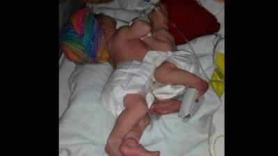 Las niñas nacieron anoche en el hospital y están bajo atención médica. Foto cortesía: Jesús Rivera / HRN
