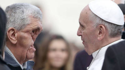 El papa Francisco saludó hoy un hombre con el rostro desfigurado. Crédito: Daily Mail