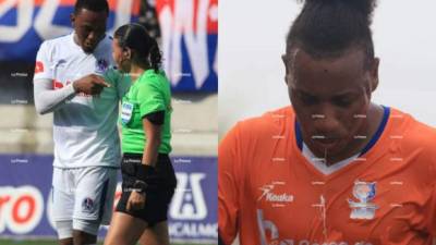 Mira las imágenes más curiosas de lo que fue la victoria de 1-3 del Olimpia ante la UPN por la ida de semifinales. La árbitro Melissa Pastrana tuvo una difícil tarde y jugador de Los Lobos fue trasladado de emergencia a un Hospital.