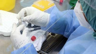 Cuatro agencias de inteligencia de EE.UU. creen que el virus tiene origen animal. Fotografía: EFE.