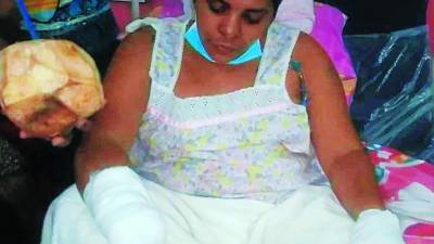 Rosaura Herrera se encuentra interna en el Hospital del Sur en proceso de recuperación, pero sin sus dos manos.