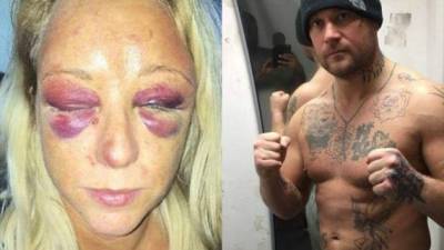 Russell Mason afirmó que fue víctima de abuso doméstico para encubrir su ataque contra su novia.Foto redes.