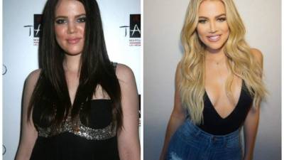 La celebridad Khloé Kardashian ha cambiado mucho su aspecto físico, aunque ella asegura que ha sido solo una buena dieta y mucho ejercicio, en comparación con su versión más joven parece otra.