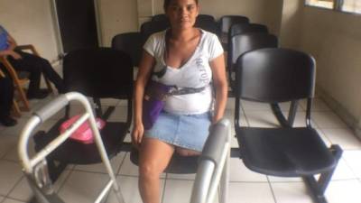 María del Carmen Almendárez perdió su pierna izquierda tras el ataque de su pareja.