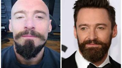 Hugh Jackman se afeitó la cabeza para ser Barbanegra.