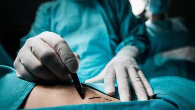 Agregó que el año pasado el país cerró con una mora quirúrgica de más de 13 mil pacientes. Imagen de archivo.