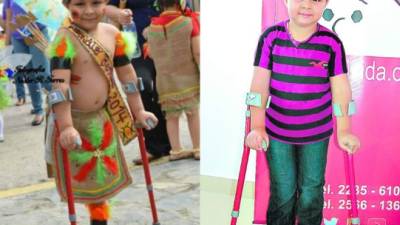 Así anduvo Danielito en los desfiles patrios de La Paz. El pequeño ahora luce por primera vez sus dos piernas. foto: cortesía fundación hondureÑa del niño con cáncer