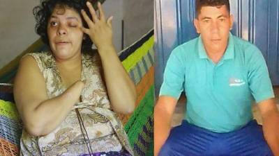 Rosaura Herrera fue macheteada en 17 ocasiones por Luis González, quien la enamoraba. Fotos: Moisés Valenzuela.