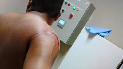 El afectado en una de las salas del hospital.