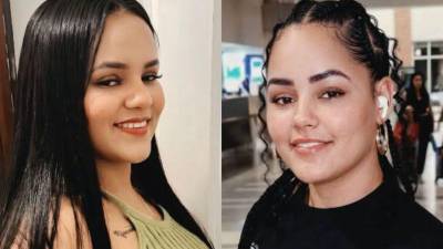 Una joven de origen dominicano, identificada como Selena Vargas, falleció el pasado miércoles en Miami, Florida, luego de sufrir presuntas complicaciones médicas tras someterse a un procedimiento estético.