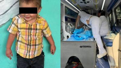 El menor fue ingresado a un centro especializado en Tegucigalpa, donde falleció por la gravedad de las quemaduras.