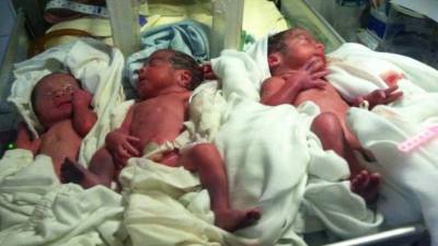 Los trillizos gozan de buena salud. Bebés necesitan ayuda.