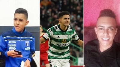 Luis Palma se ha convertido en el legionario hondureño del momento por su actualidad en Europa con el Celtic y en la Selección de Honduras. Así ha cambiado el delantero desde sus inicios en el fútbol con el Vida y pasando por las categorías menores de la Bicolor.