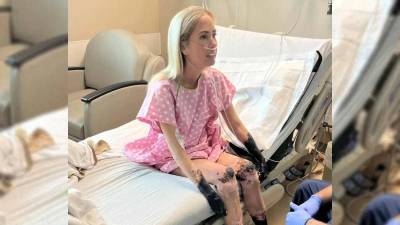 Maestra pierde pies y manos por una enfermedad que se las “momificó”