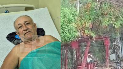 Una tarde que parecía una simple pausa para protegerse de la lluvia terminó en tragedia e incredulidad en el barrio Alvarado de La Ceiba, Atlántida, luego de que una descarga eléctrica dejara a un hombre hospitalizado y provocara la muerte instantánea de su acompañante.