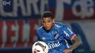 Juan Izquierdo: Informe médico revela causa de su muerte