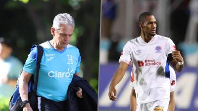 Reinaldo Rueda mencionó a Bengtson tras la derrota ante Islandia, ya que esa zona es una de las más necesitadas y donde se debe prestar mayor atención ante la baja de Choco Lozano.