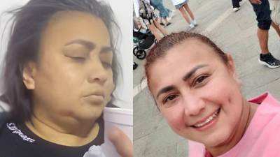 La desaparición de Yulixa Toloza, una mujer de 52 años, ha generado conmoción en Bogotá y reavivado las alertas sobre los riesgos de someterse a procedimientos estéticos clandestinos en Colombia.