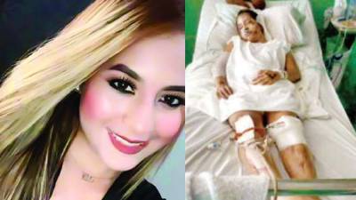 Hazel Michelle Cortés de 19 años se encuentra grave después de haber sido atropellada por su exnovio Fabricio Matute.