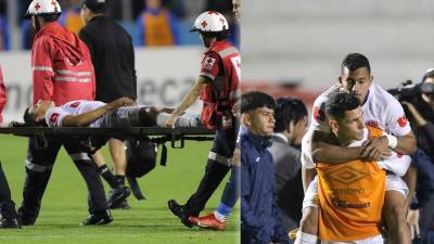 Carlos Pineda y Edwin Rodríguez se retiraron lesionados del juego de ida de la final contra el Motagua.