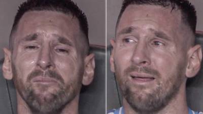 Duele verlo: Messi se va lesionado y llorando en la final de Copa América 2024