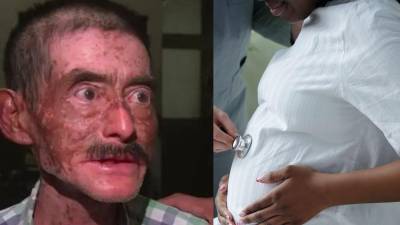 Una escena estremecedora sacudió a una comunidad en el puerto de San José, Escuintla, Guatemala, donde un hombre fue arrestado tras presuntamente abrir el vientre de su propia hija embarazada para extraer al bebé que llevaba en gestación.