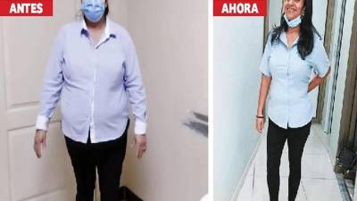 Lurby Jasennia Madrid (de 38) perdió más de 91 libras tras realizarse una manga gástrica.