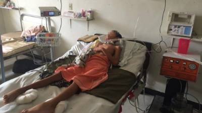 El niño está en la cama 75 de la sala pediátrica del Mario Rivas.