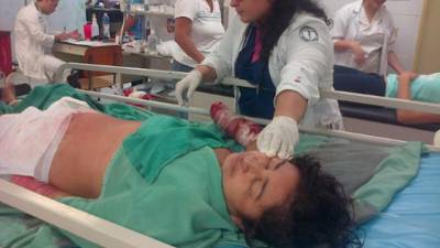 Gloria Estela Pérez (34) perdió ambas manos luego de su exesposo la atacara con un machete.