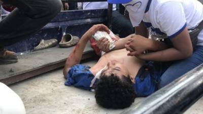 Nicaragua sigue sumida en el caos luego de que al menos 1 personas murieran y otras 79 resultaran heridas en los ataques ocurridos entre ayer y hoy en el marco de manifestaciones a favor y en contra del Gobierno de Daniel Ortega, informó este jueves el Centro Nicaragüense de Derechos Humanos (Cenidh). Foto: Twitter Wilfredo Miranda.