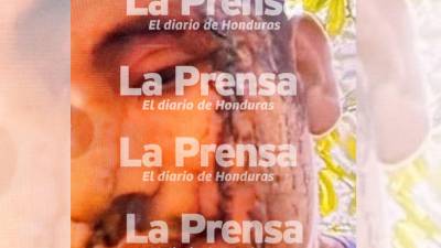Exclusiva: Fotografía de Esteban Ferrera, alias El Diablo, herido