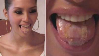 La candidata a Miss Venezuela 2014 Wi May Nava es el vivo ejemplo de haberse costurado la lengua con esta famosa malla.