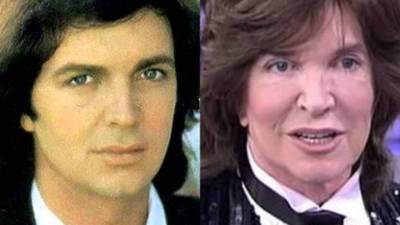 El antes y después de Camilo Sesto.