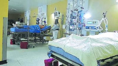 Unos 20 pacientes son recibidos al mes en la UCI.