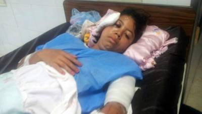 Lesbia Sulay Perdomo se recupera satisfactoriamente de las heridas de machete que sufrió en el rostro, brazo izquierdo y la espalda.
